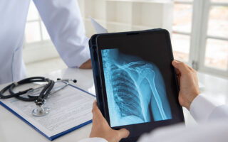 shoulder joint x-ray image on digital tablet with doctor team medical diagnose  injuries of tendons and bones.